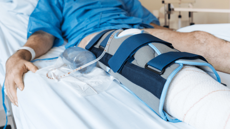 A patient in a hospital bed with a wrapped and braced leg rests on white sheets. Medical equipment and a blue hospital gown are visible, suggesting recovery.